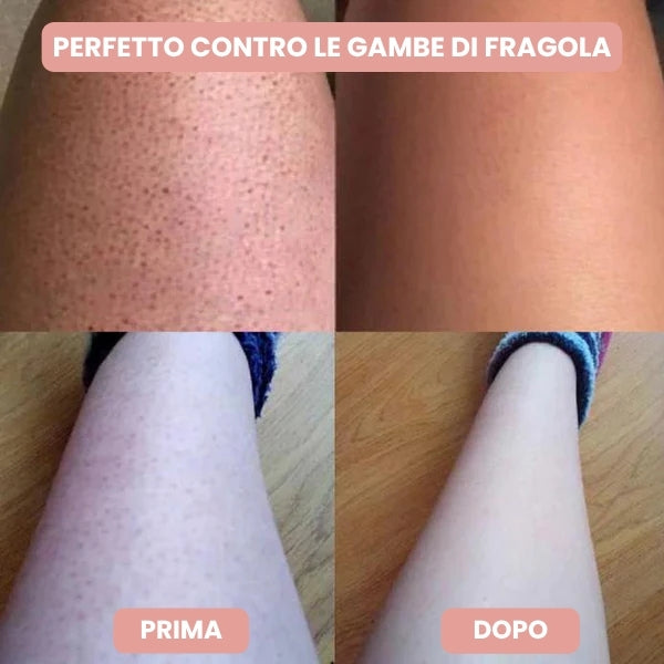 Venarox™ Rasoio Premium