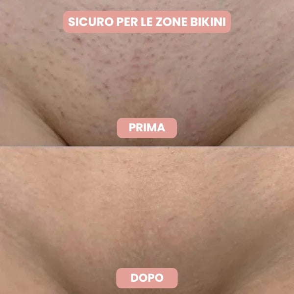 Venarox™ Rasoio Premium