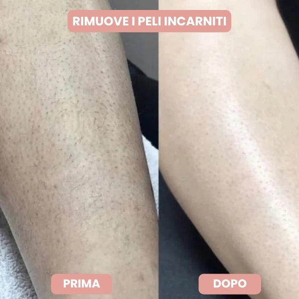 Venarox™ Rasoio Premium